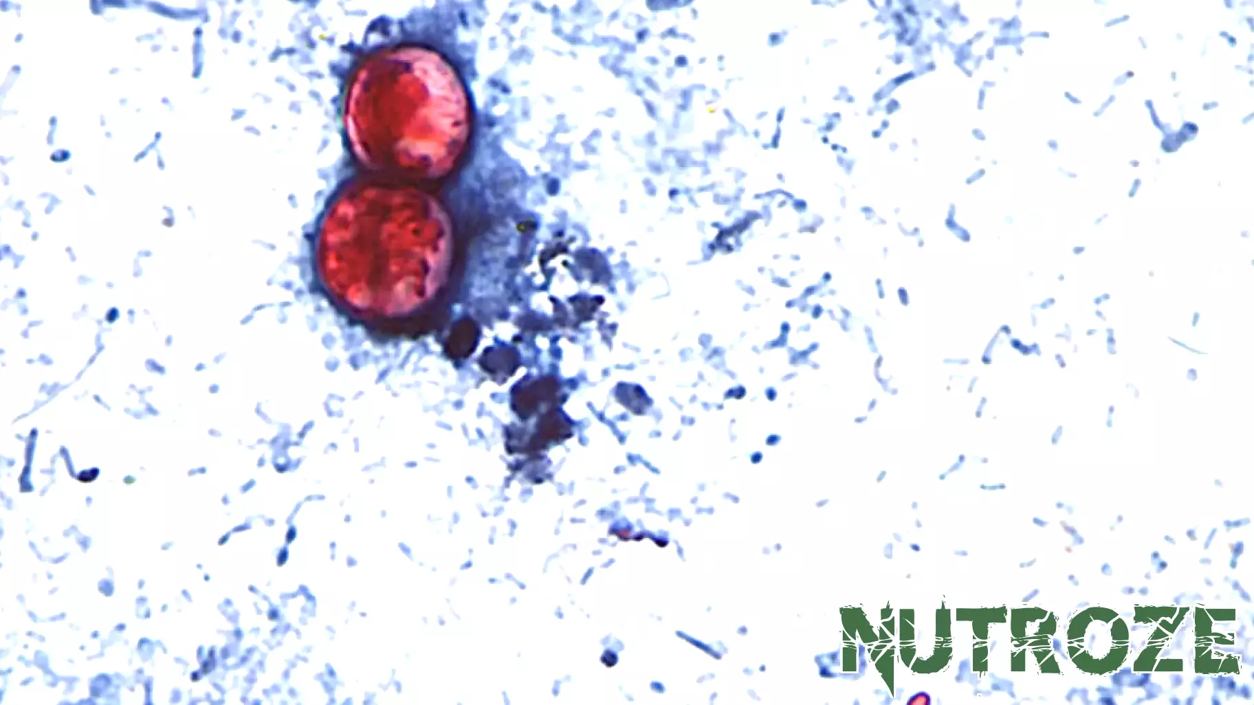 How health officials are racing to track foods behind cyclosporiasis outbreak in over 27 states