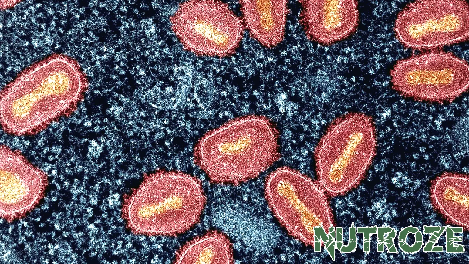 SF Department of Public Health confirms first clade I mpox case