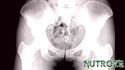 Bone Density Measures Give Insight Into Overall Health Risk in Older Women