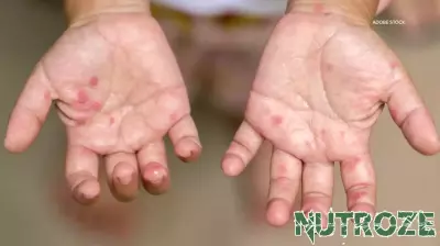 First Cases of Measles Confirmed in Tarrant County