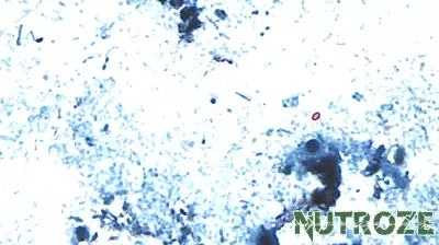 Georgia health officials warn of seasonal Cyclospora risk as parasite cases rise nationwide