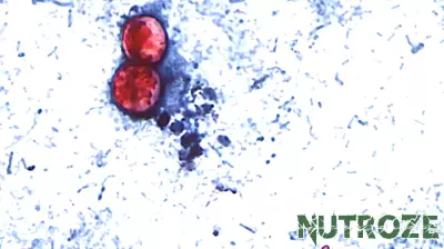 How health officials are racing to track foods behind cyclosporiasis outbreak in over 27 states